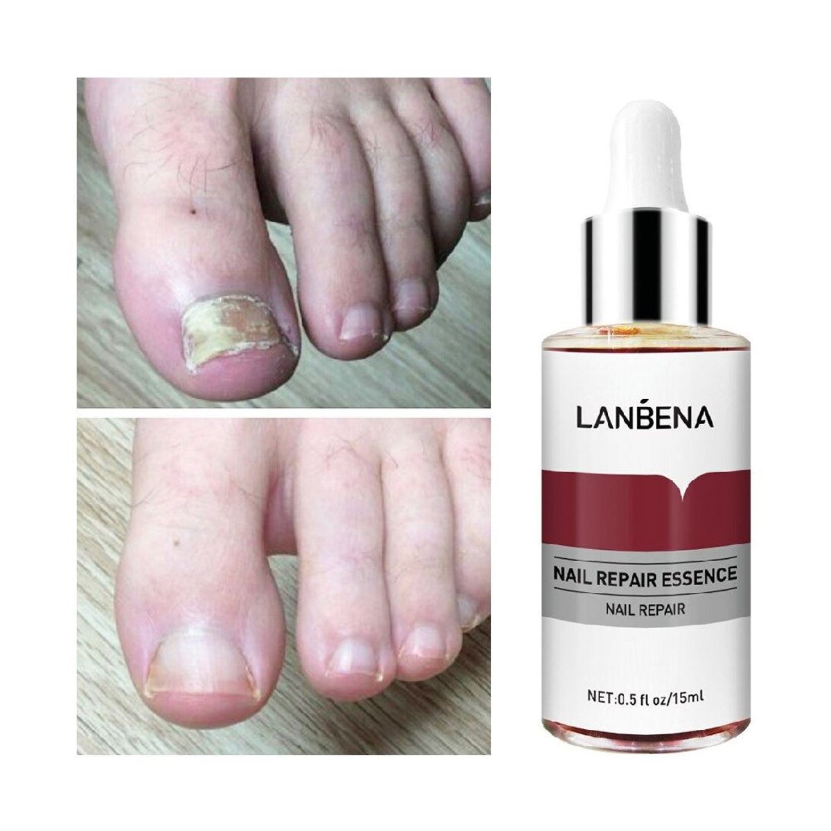 GENERICO - Esencia Reparadora de Uñas de Pies y Manos Anti-Hongos