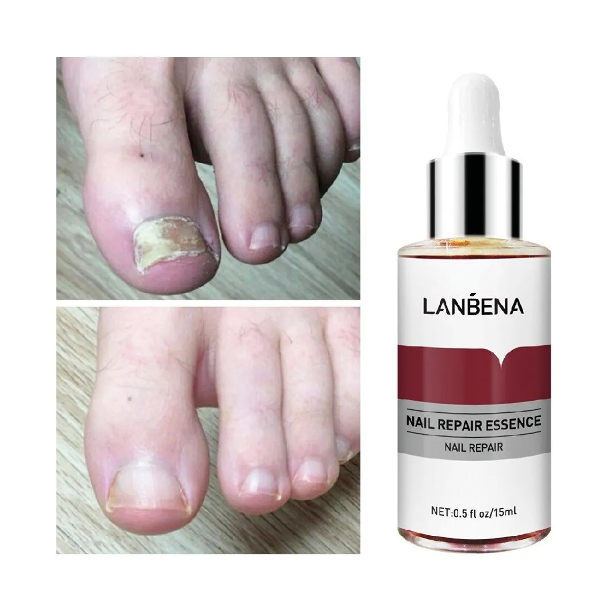 GENERICO - Esencia Reparadora de Uñas de Pies y Manos Anti-Hongos