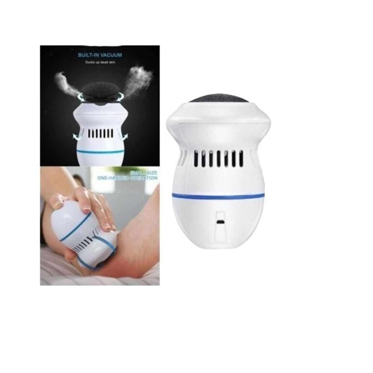 GENERICO - MAQUINA REMOVEDOR DE CALLOS CON ASPIRADOR A PILAS