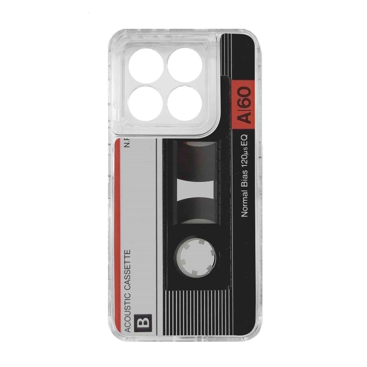 GENERICO - Funda Protector Case 360 Para XIAOMI 14T
