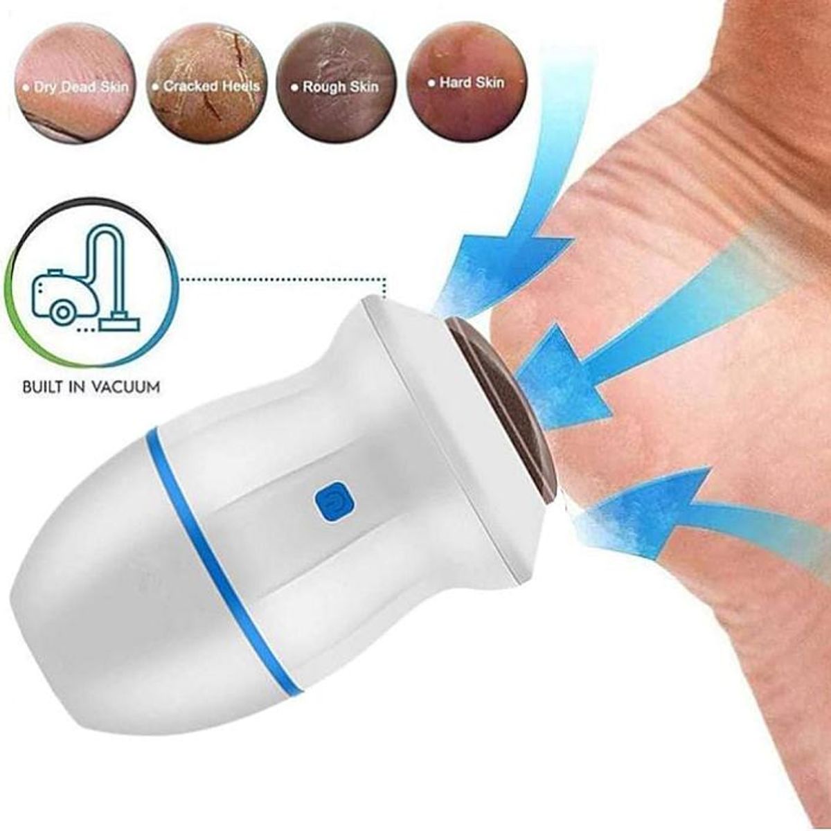 GENERICO - MAQUINA  ELECTRICA PARA CALLOS