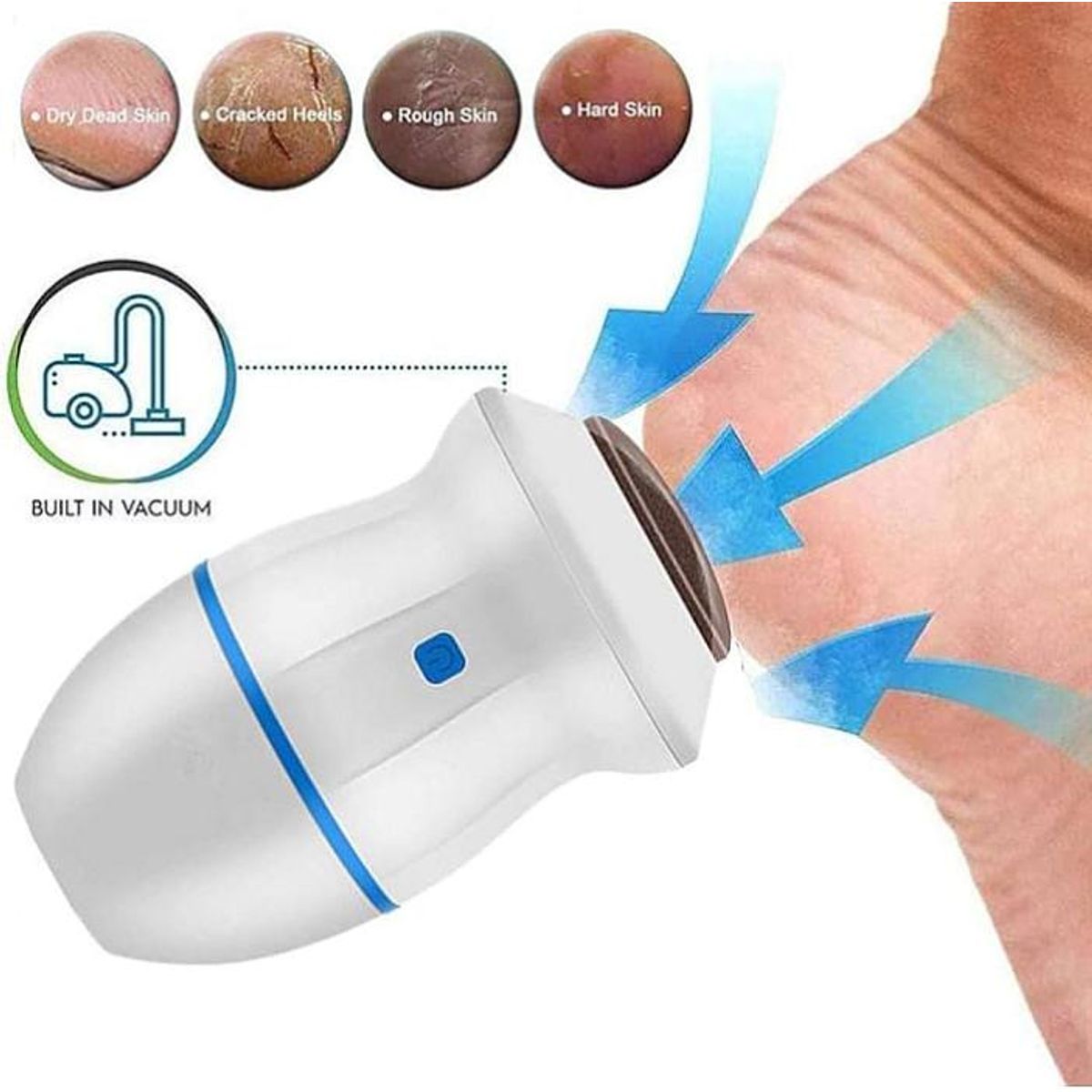 GENERICO - MAQUINA  ELECTRICA PARA CALLOS