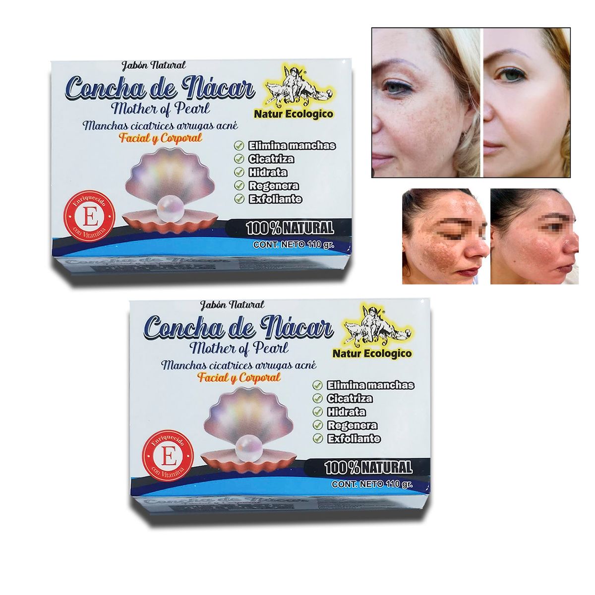 GENERICO - Jabón natural aclarante y blanqueador de zonas oscuras