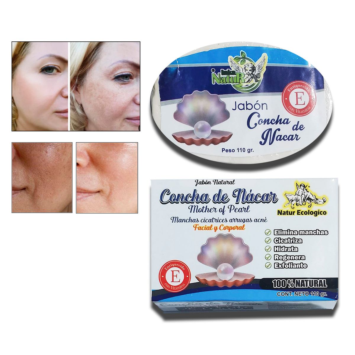 GENERICO - Jabón natural aclarante y blanqueador de zonas oscuras