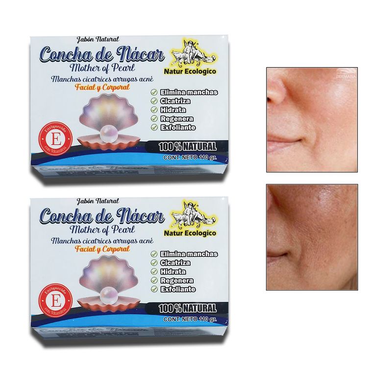 GENERICO - Jabón De Arroz Blanqueador & Aclarador De Zonas Oscuras 110g