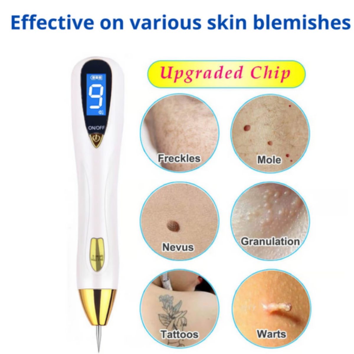 OEM - Eliminación de VERRUGAS + LUNARES Cauterizador plasma RECARGABLE