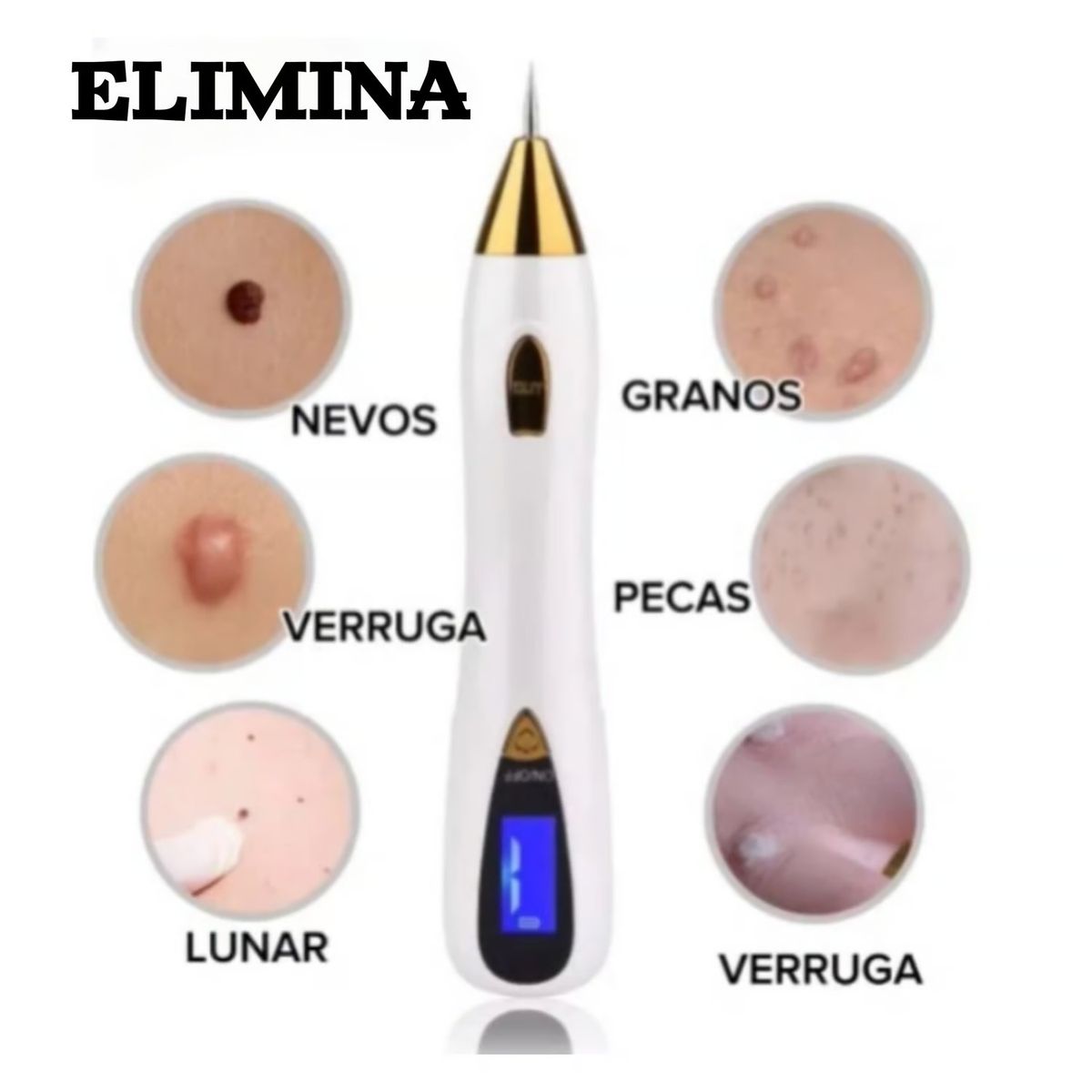 OEM - Eliminación de VERRUGAS + LUNARES Cauterizador plasma RECARGABLE