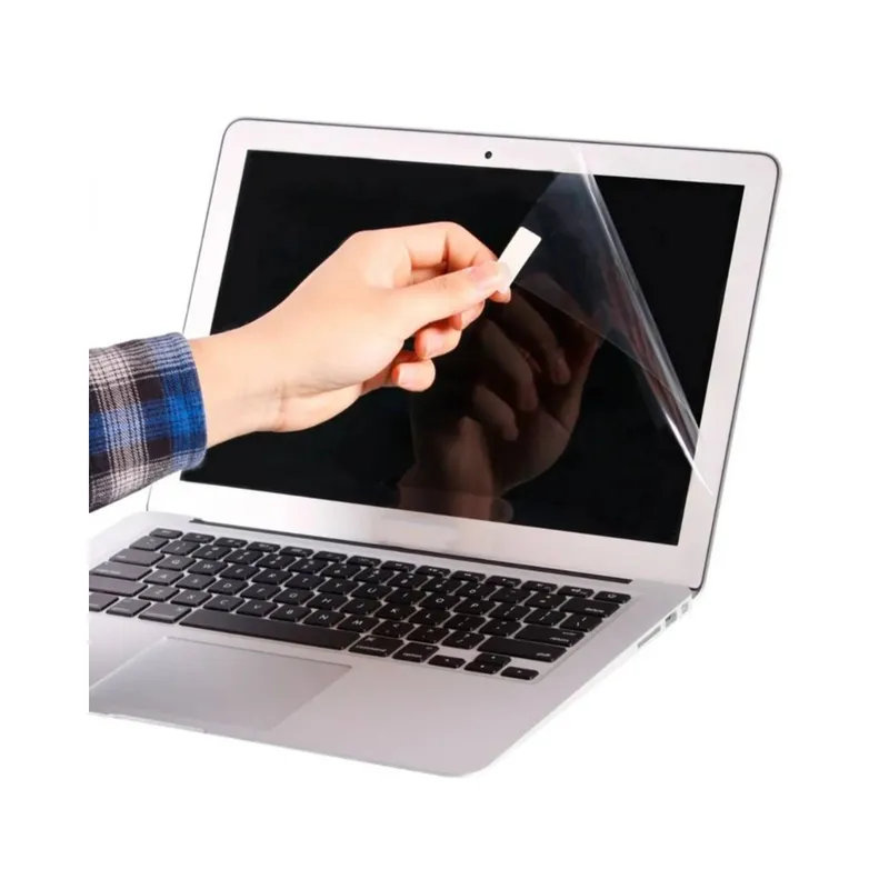 GENERICO - Kit Protector 3 en 1 para Laptop – Vinil Protector Total