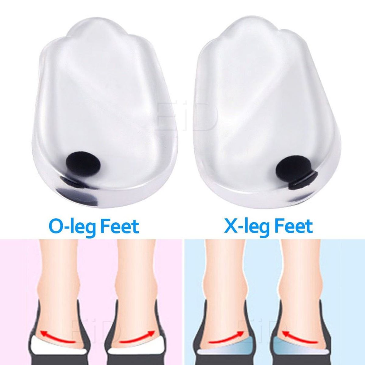 OEM - Plantillas de Gel para Corregir Piernas X u O y Cuidar los Pies