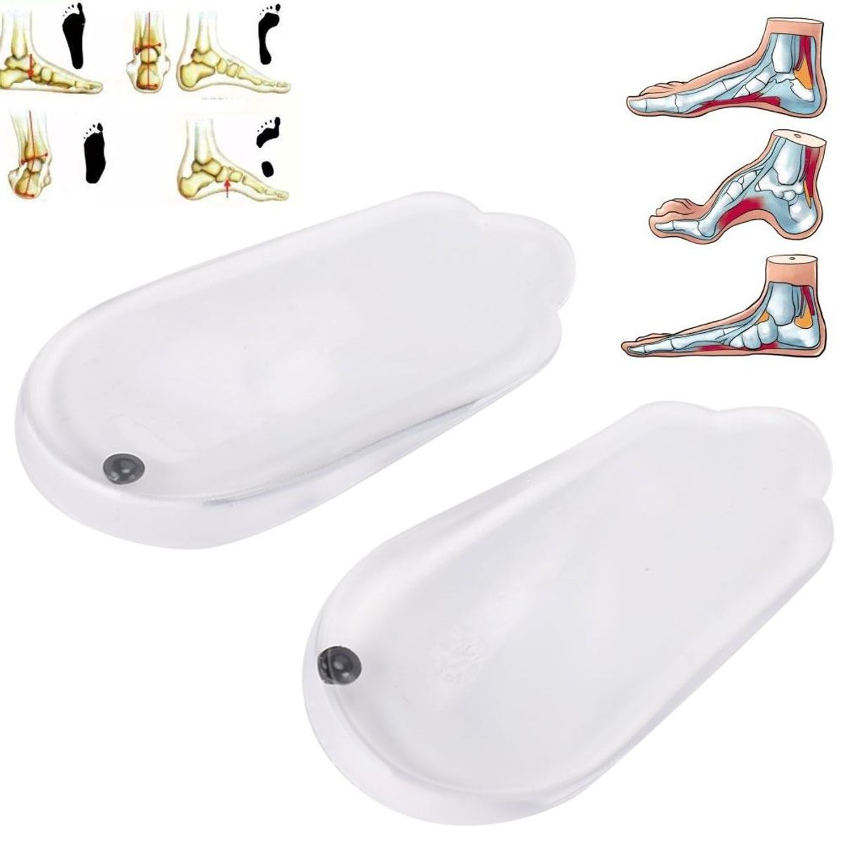 OEM - Soporte de Gel Ort0pédico para Fasc1tis Plantar y Piernas en X y O