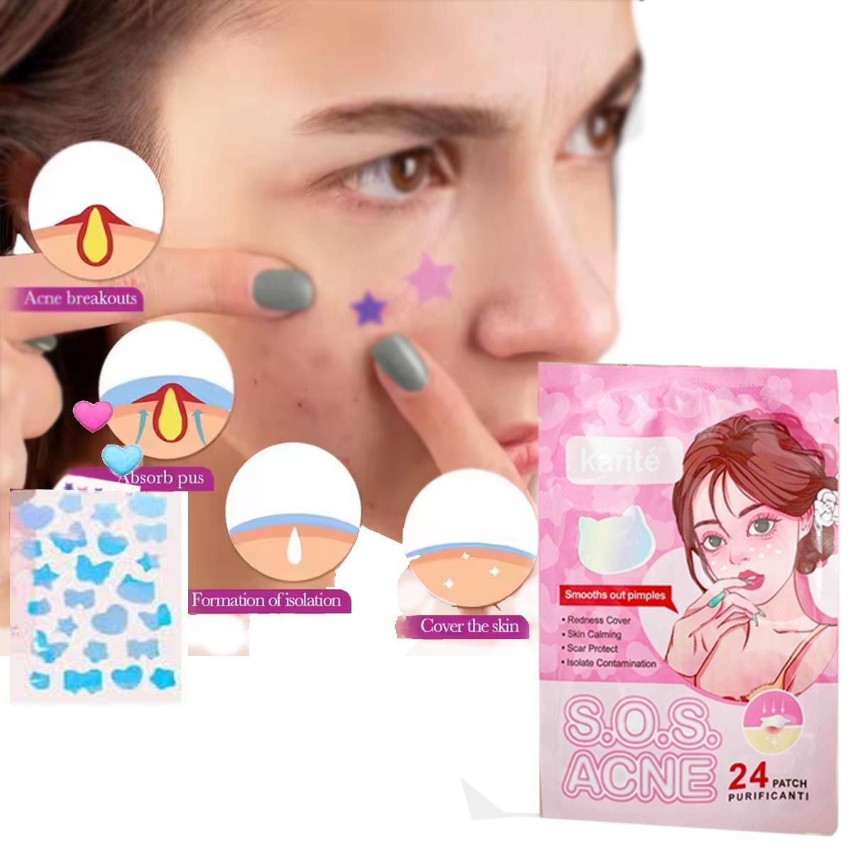 GENERICO - 24 PARCHES SOS ACNÉ DE FORMITAS DÍA NOCHE