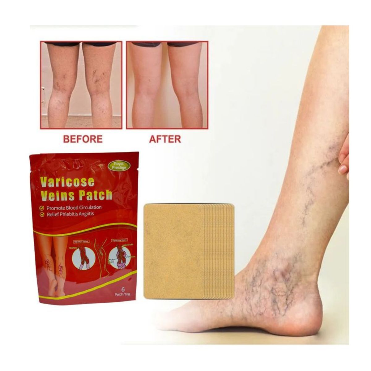 GENERICO - PARCHES PARA VARICES