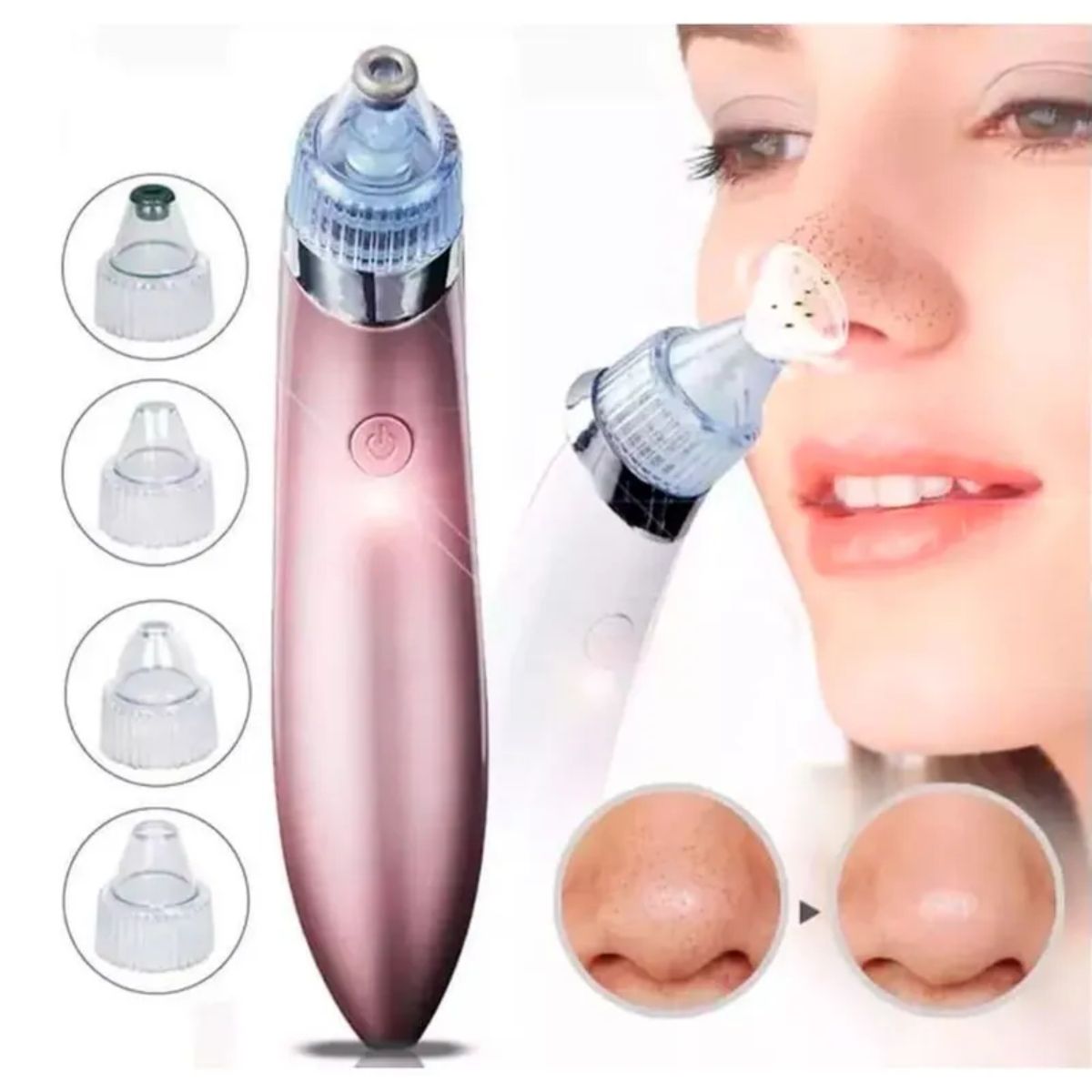 GENERICO - Limpiador facial succionador puntos negro aspirador de acné espinilla