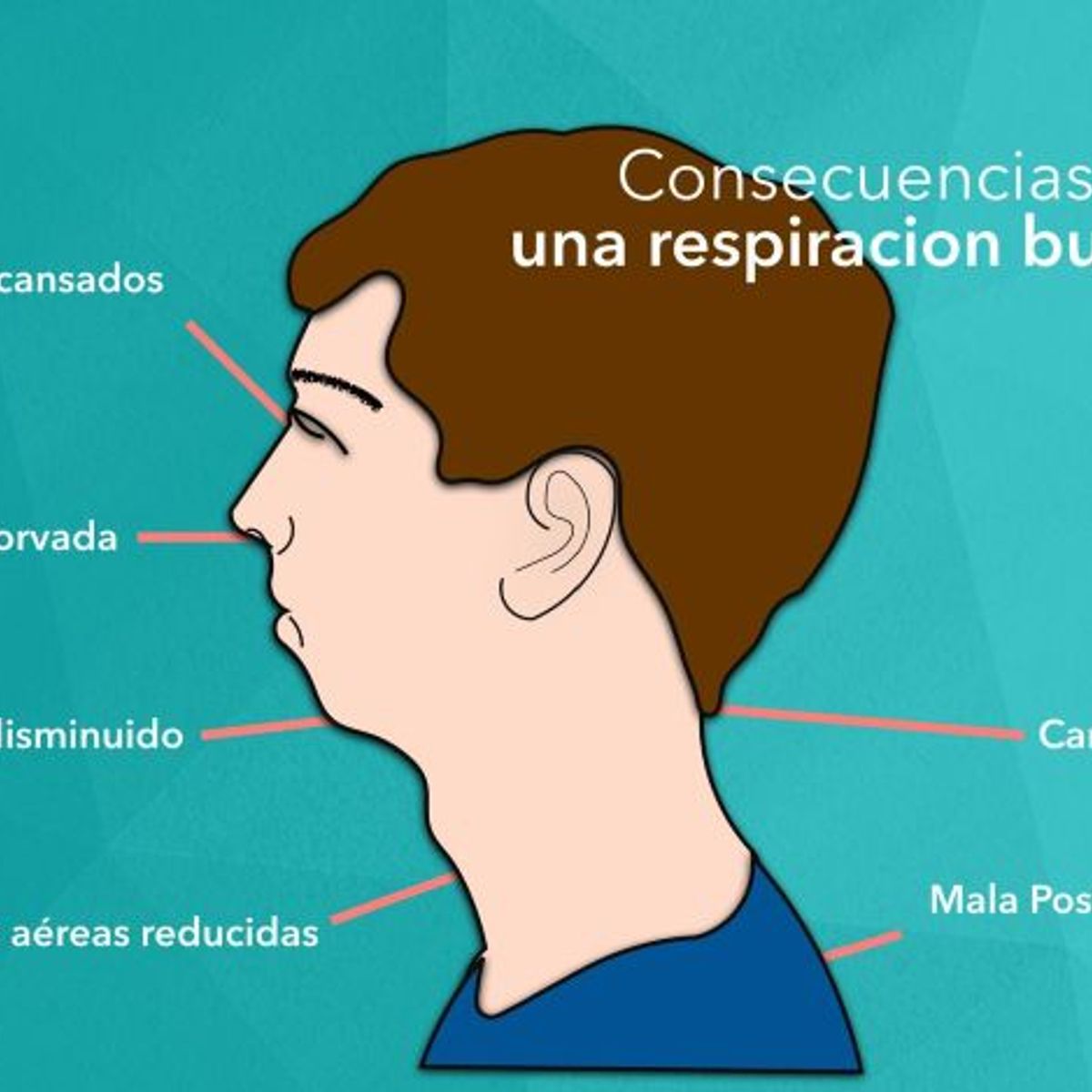 GENERICO - Cinta Parche Bucal Tape para Dormir Antironquidos Respira Mejor