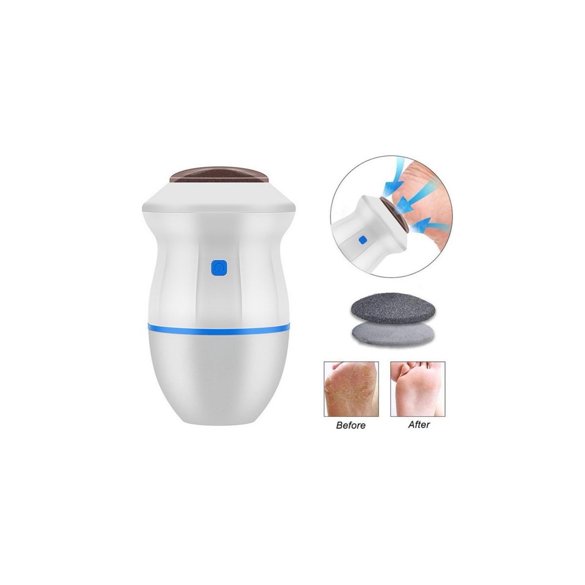 GENERICO - REMOVEDOR DE CALLOS PARA PIES