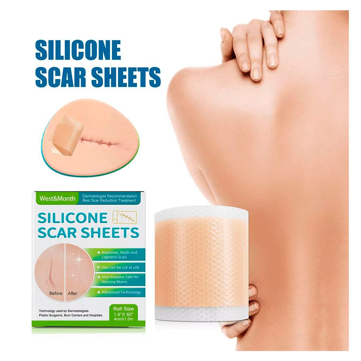 GENERICO - Parches Gel De Silicona Médica Reusables Cicatrices Cirugia WESTMONTH