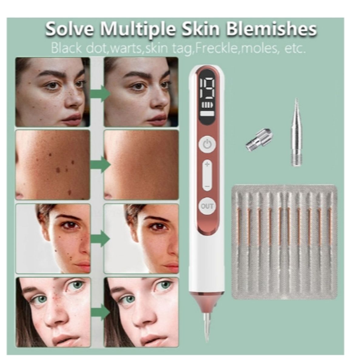 GENERICO - pluma de Plasma eliminación de tatuajes láser eléctrico