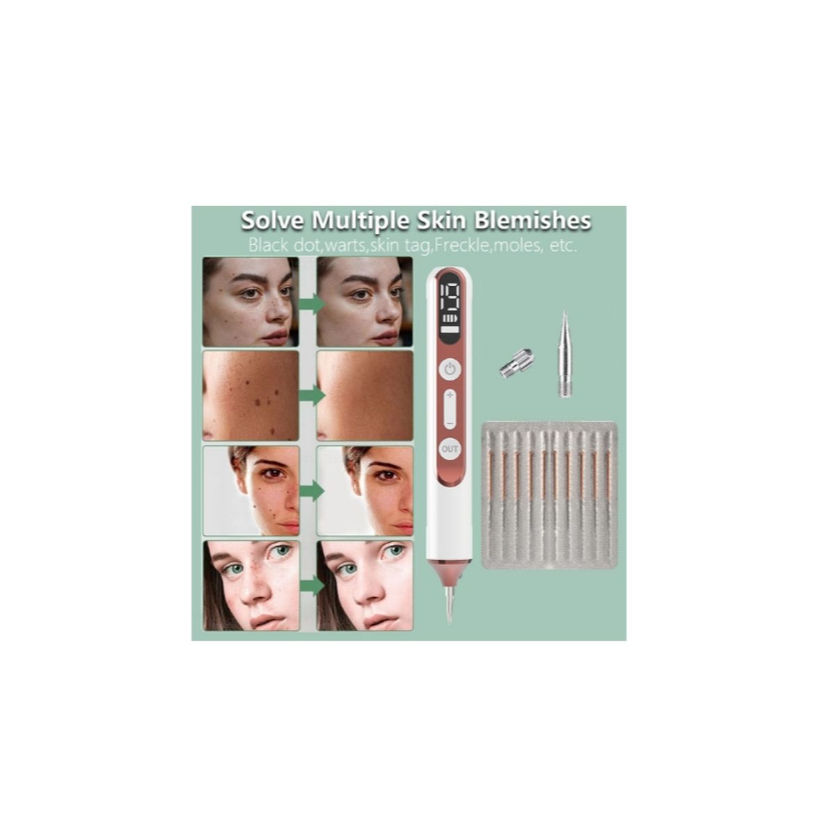 GENERICO - pluma de Plasma eliminación de tatuajes láser eléctrico