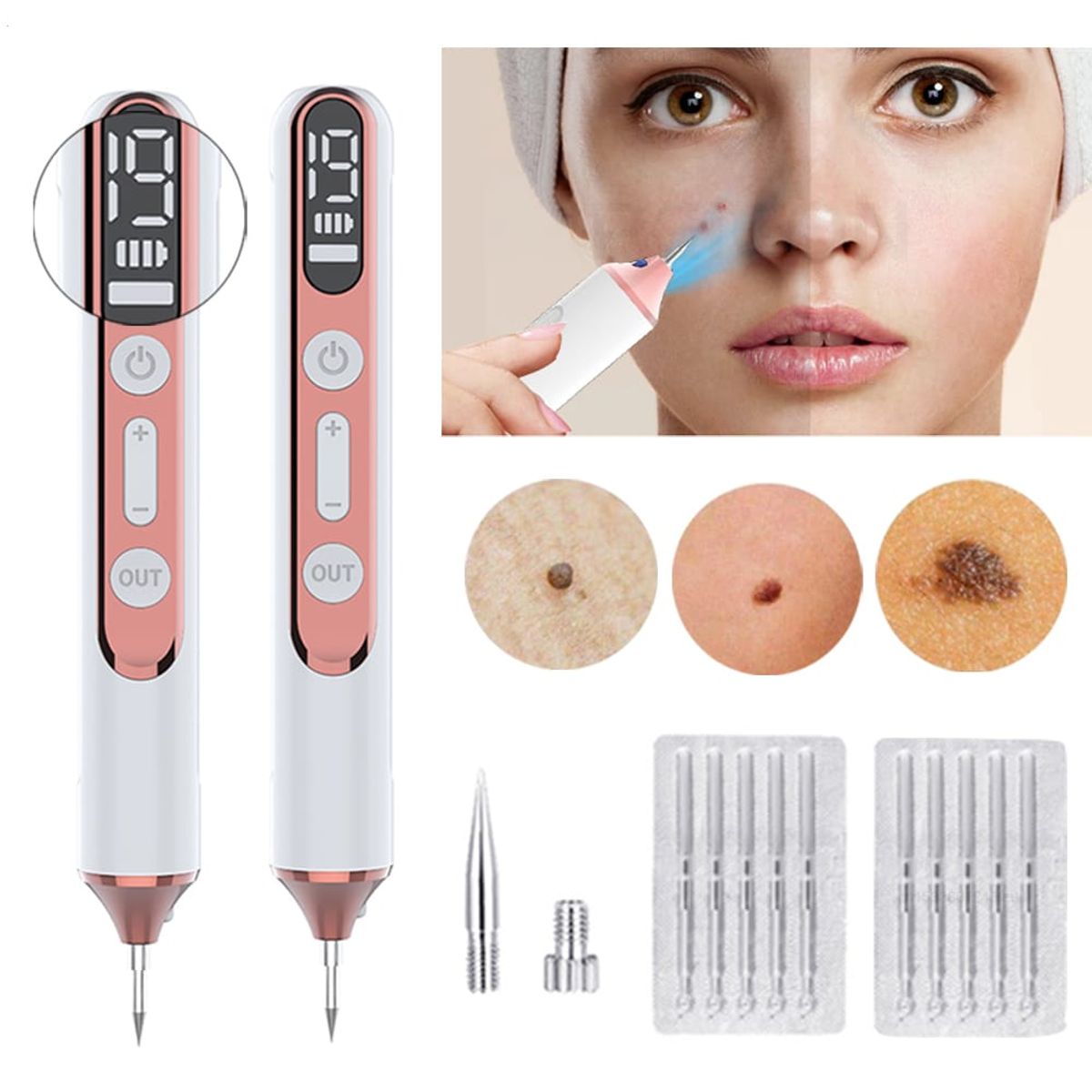 GENERICO - pluma de Plasma eliminación de tatuajes láser eléctrico