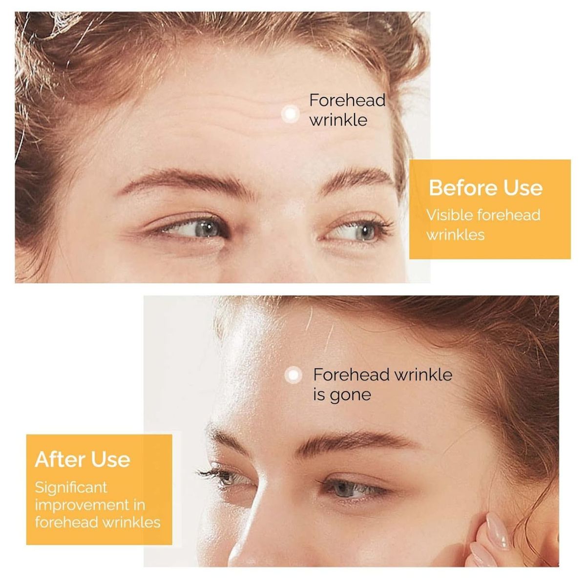 BEAUTIFUL - Parches antiarrugas para la frente 10 Und. Alisa y Tensa la Piel