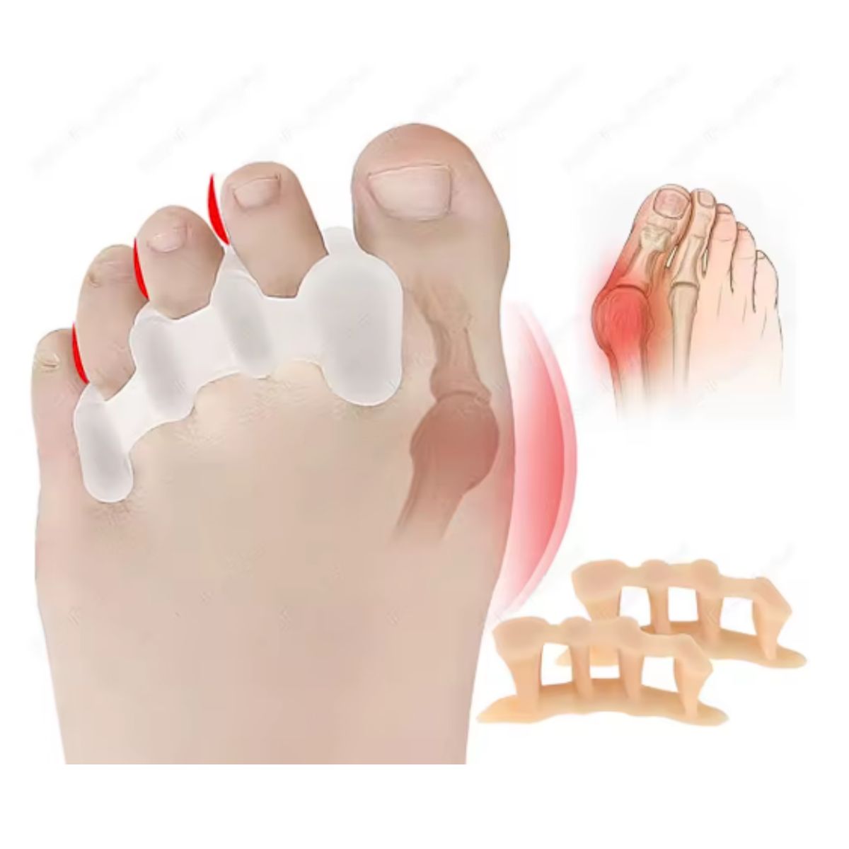 GENERICO - Almohadilla gel dedo gordo separador superpuesto juanete plantilla