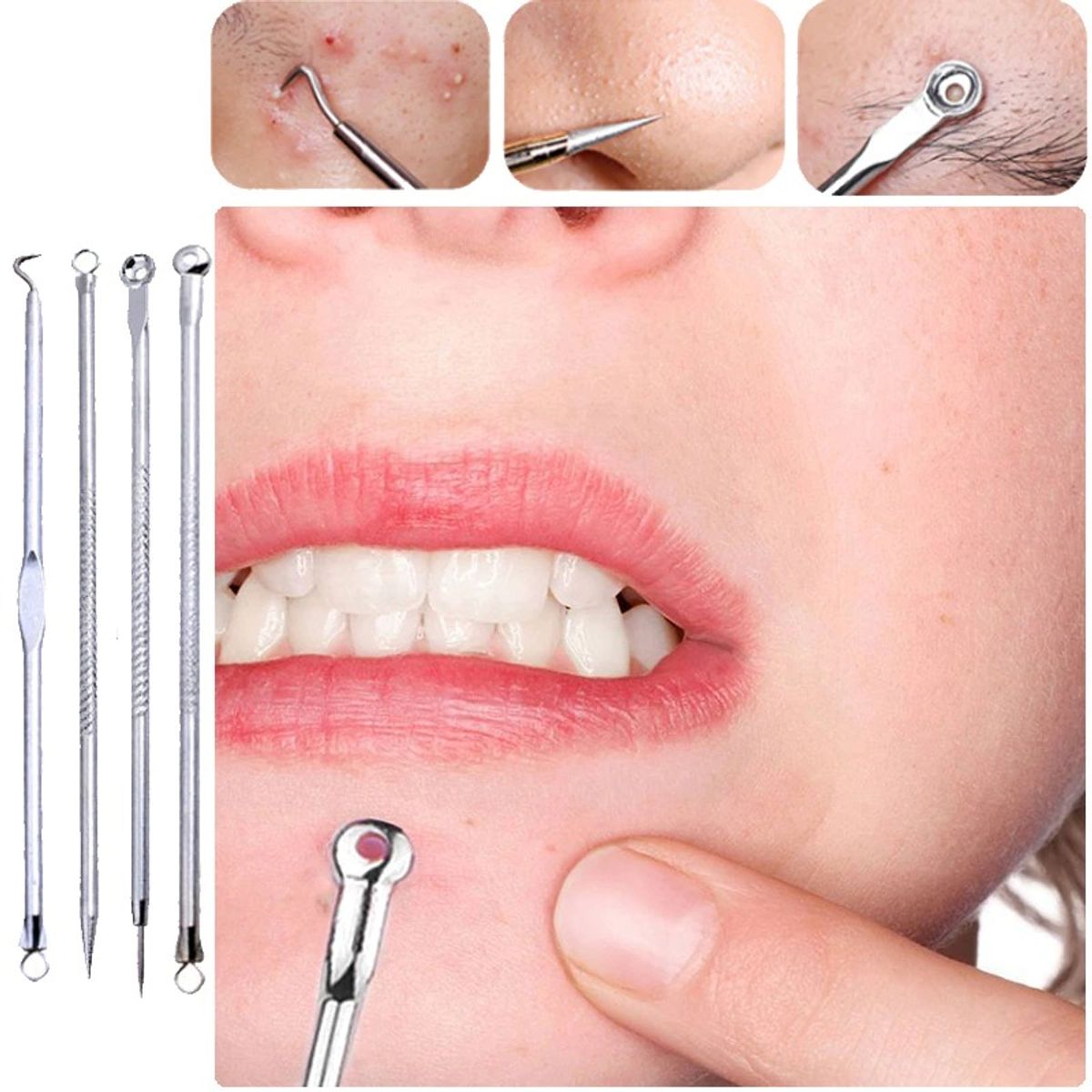 GENERICO - Extractor de Espinillas 4 piezas Limpieza Barritos Acne