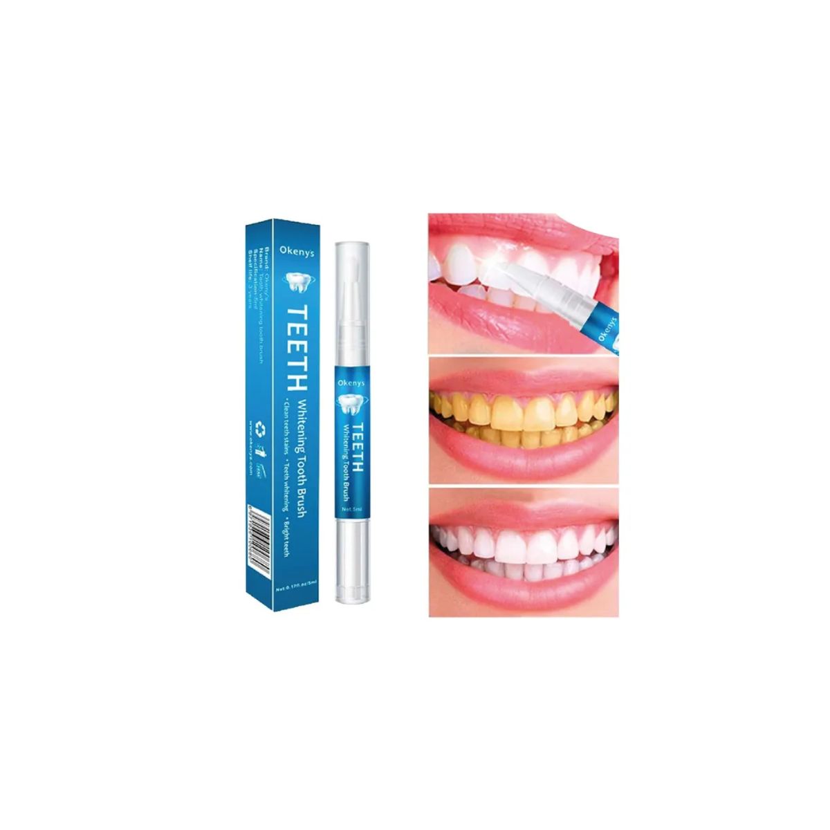 GENERICO - Lápiz Blanqueador Dental La Clave Para Una Sonrisa Deslumbrante