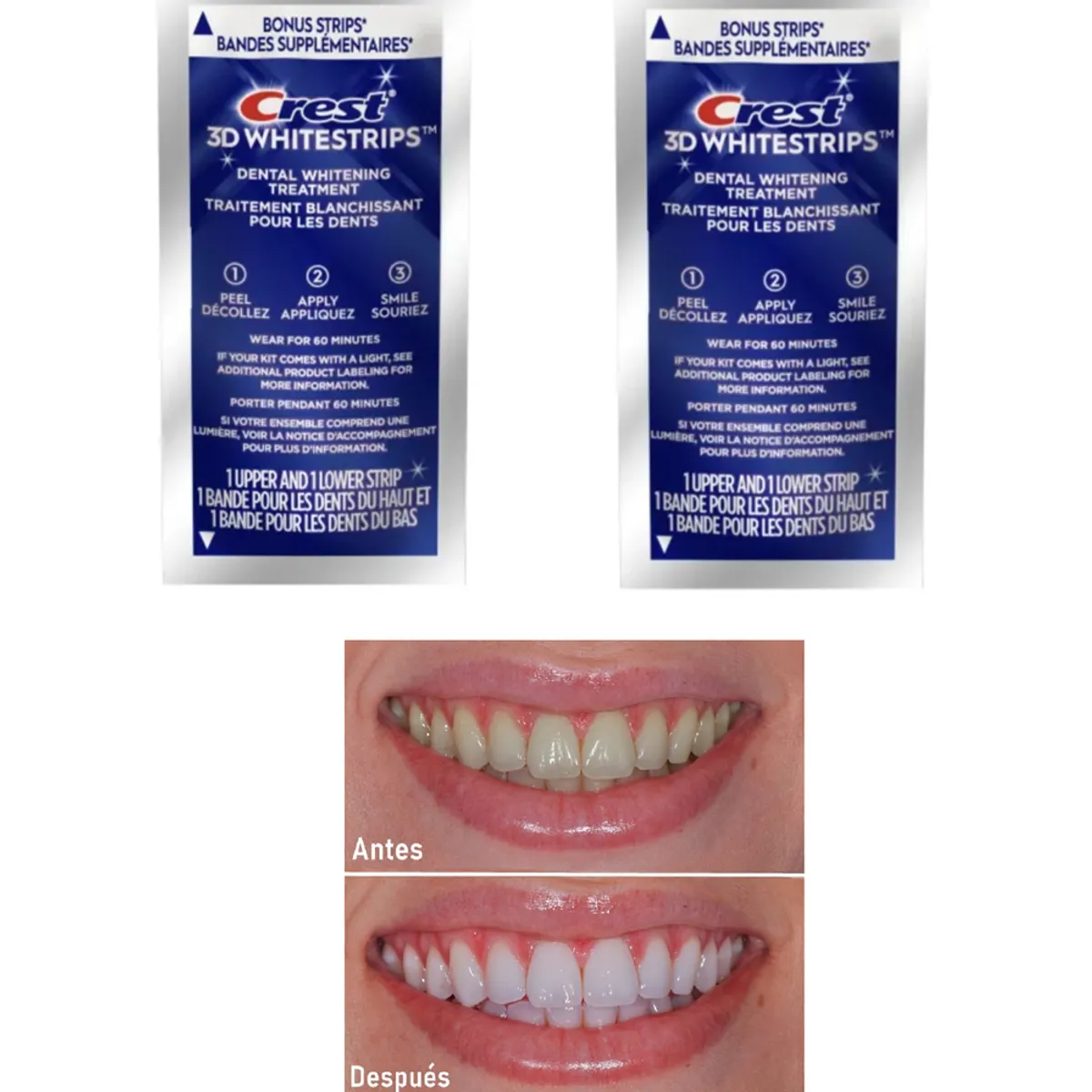 JM IMPORT - TIRAS BLANQUEADORAS DIENTES BLANCOS PACK X 4 dental