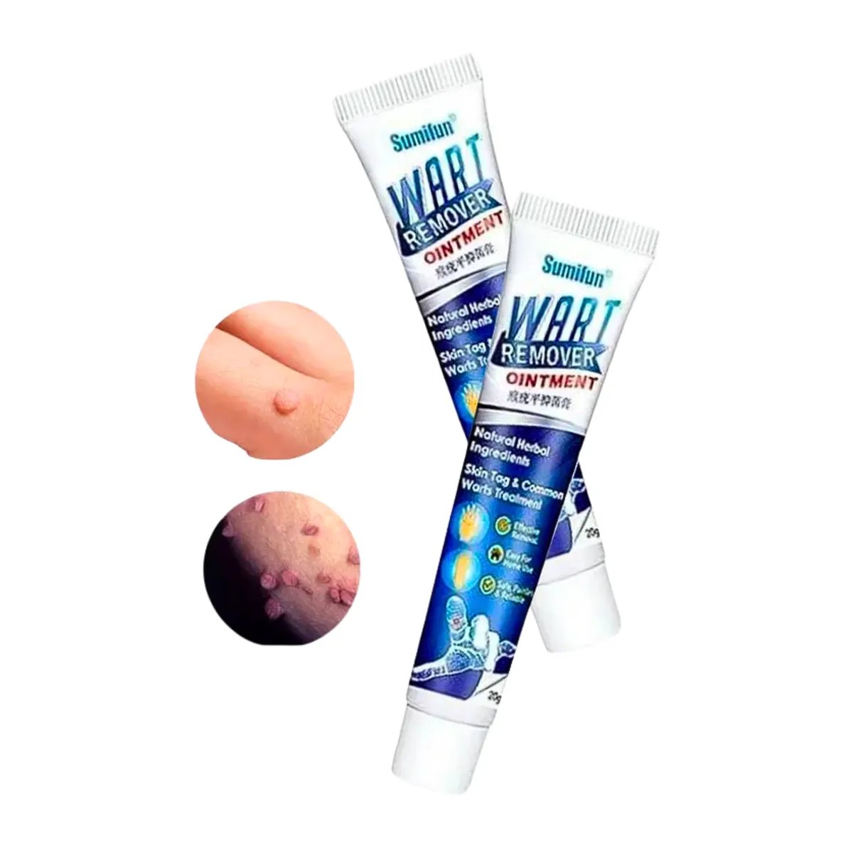 GENERICO - Sumifun Removedor de Verrugas para el VPH