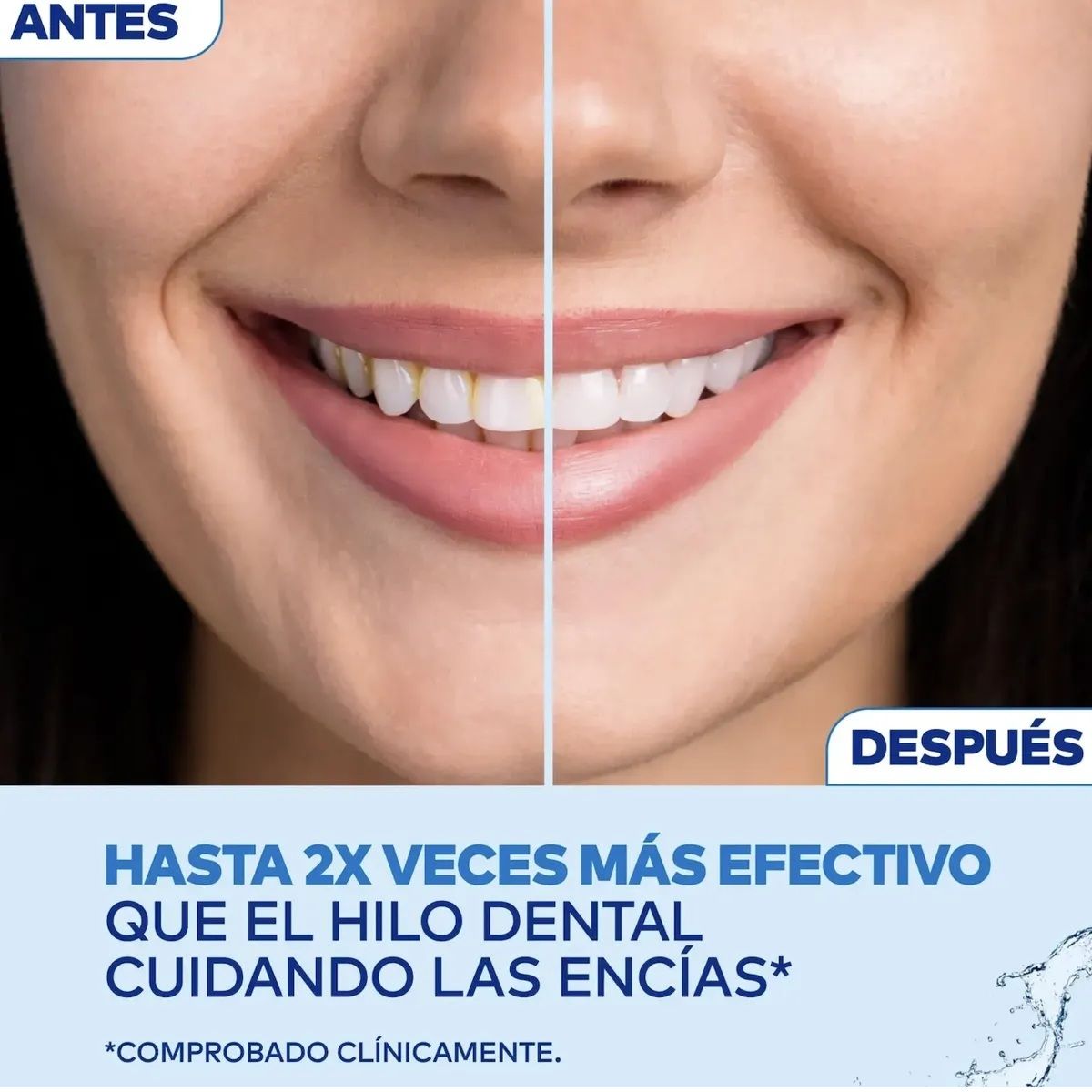 WATERPIK - Irrigador Bucal Waterpik Pearl Inalambrico 4 Puntas 2 Nivel