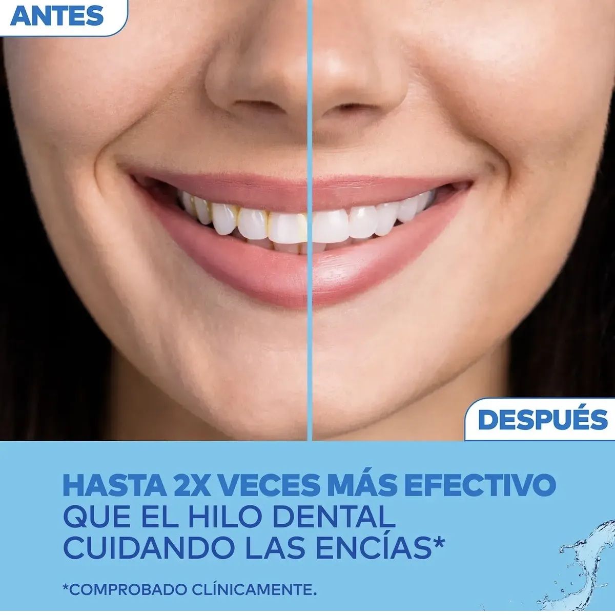 WATERPIK - Irrigador Bucal Waterpik Basico Inalambrico 2 Boquilla 2 Int