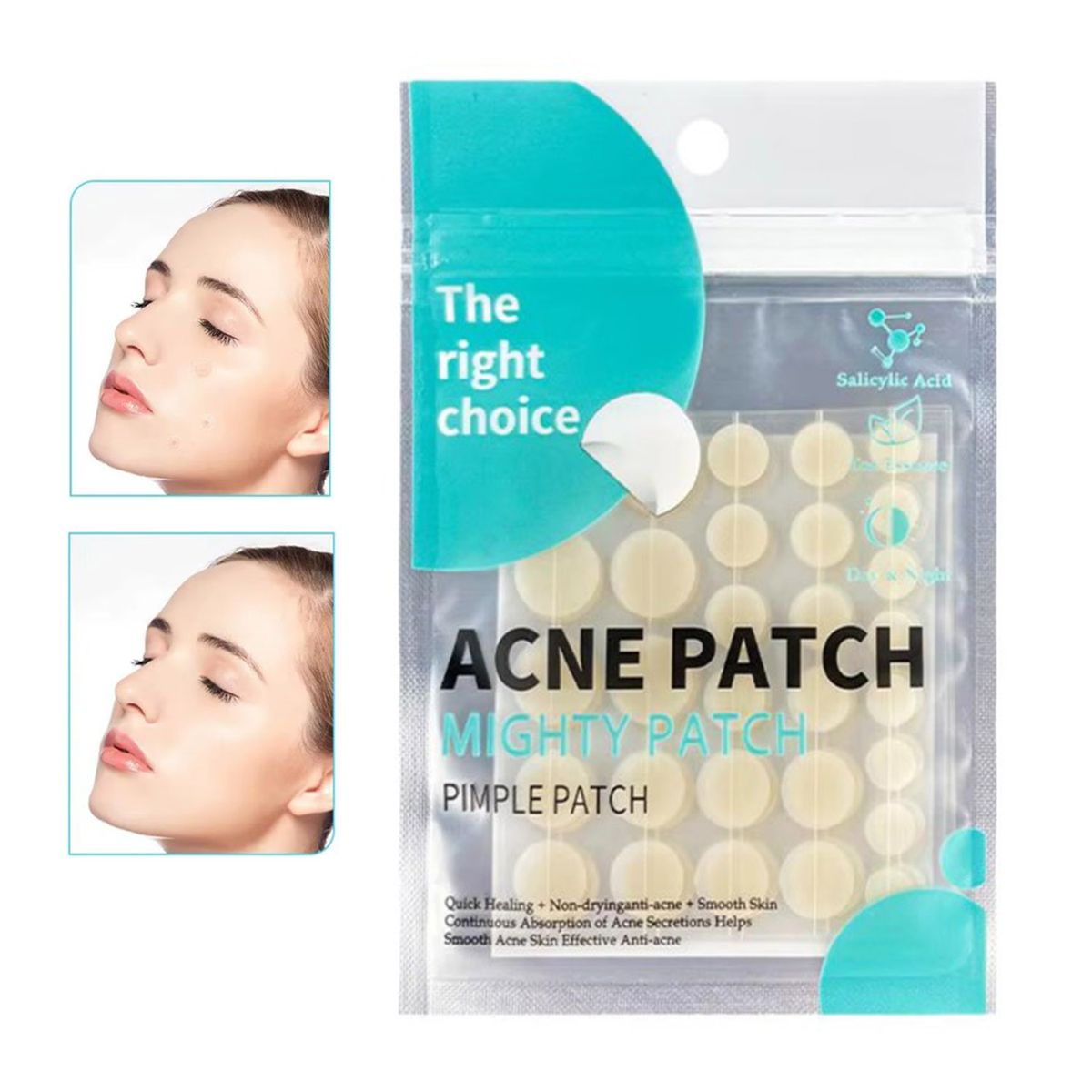 GENERICO - ACNE PLASTERS anti acné espinilla granos 30 und