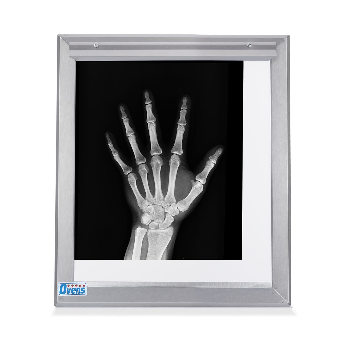 GENERICO - Negatoscopio Fluorescente de 1 Campo en Acero Integro