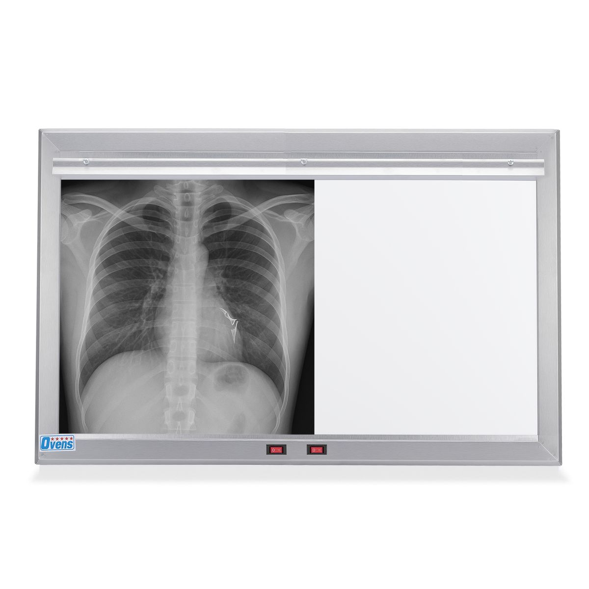 GENERICO - Negatoscopio LED de 2 Campos en Acero Satinado