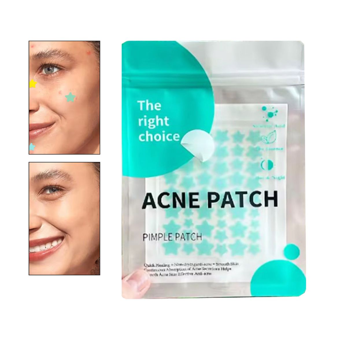GENERICO - ACNE PLASTERS elimina acné y granos 51 und estrellitas