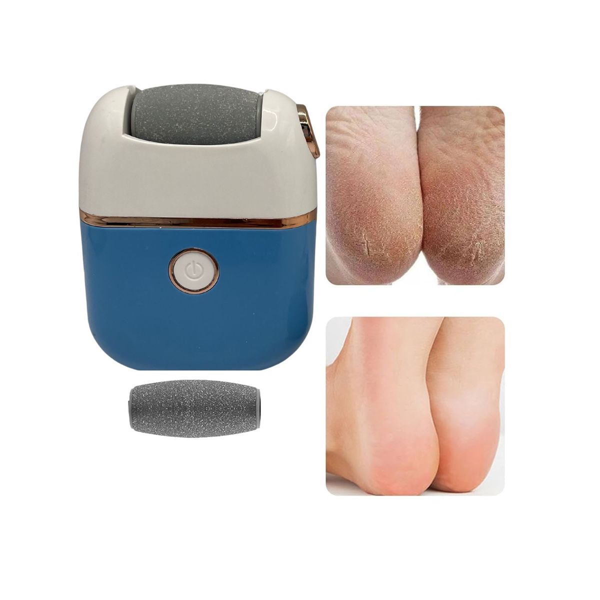 OEM - Removedor Electrico de Callos Para Pies + Exfoliante De Pies Arroz