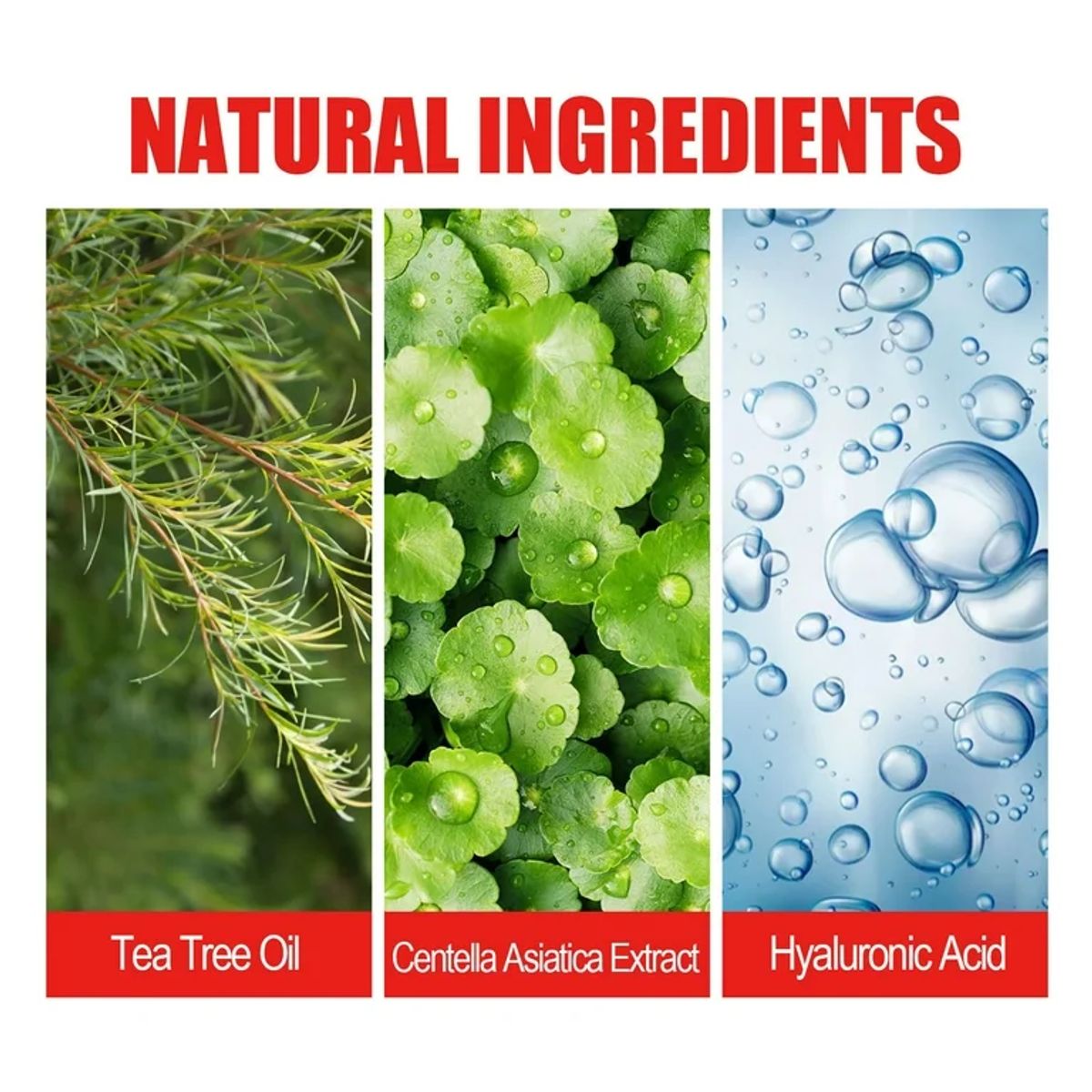 GENERICO - TRATAMIENTO ANTIACNE PARCHES ANTI GRANOS HIDROCOLOIDE ESPINILLAS 200 UNIDADES