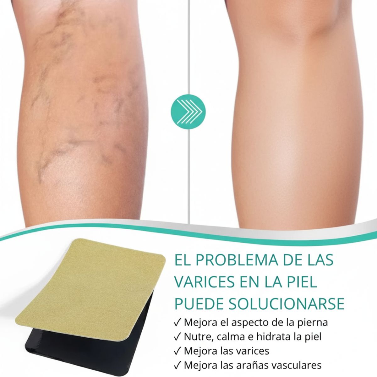 GENERICO - Parches Varices VeinHealth