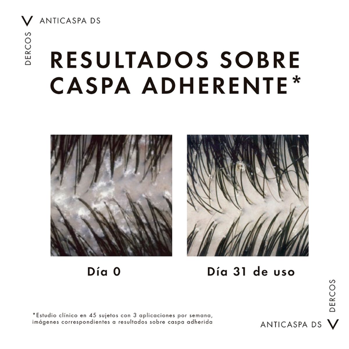 PREMIUM - SHAMPOO DERCOS Anticaspa 200ML Cabello Graso Original