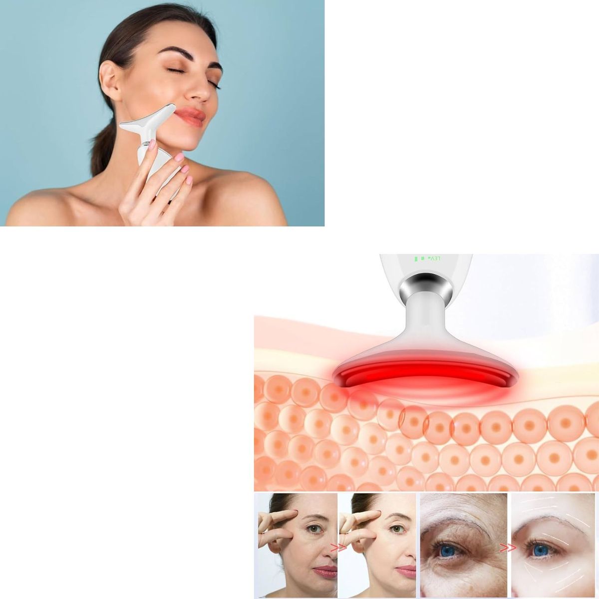 OEM - Masajeador Electrico Reductor de Arrugas Papada