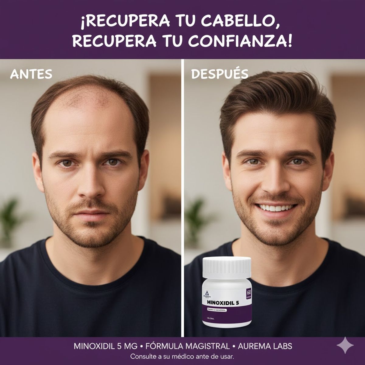 GENERICO - minoxitina 60 capsulas
