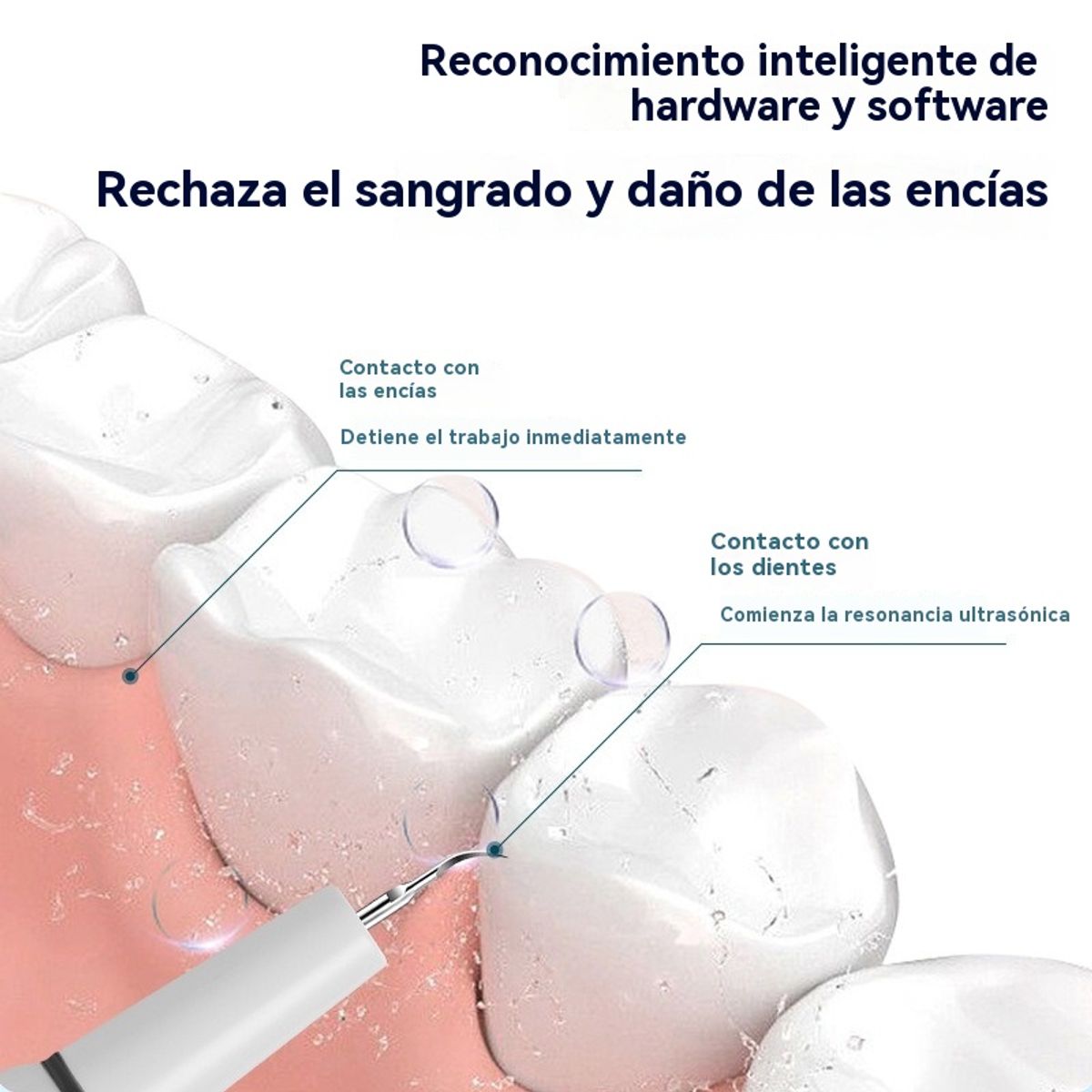 GIOIO - Limpiador dental ultrasónico portátil elimina sarro