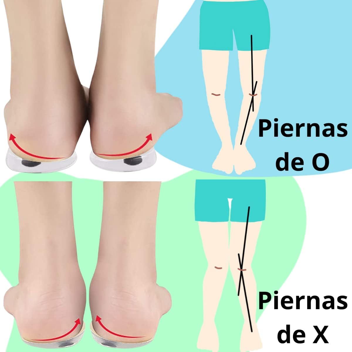 OEM - Plantillas Correctoras de Piernas Tipo O/X y Pronación de Silicona - 1 Par