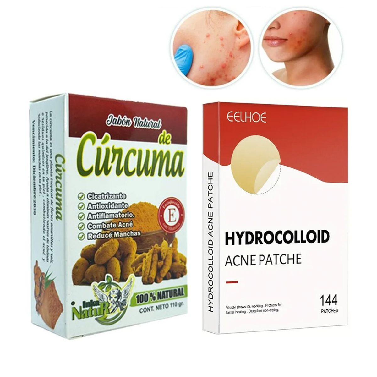 GENERICO - PATCH eliminador de acne144 unidades jabon de curcuma anti-inflamatoria