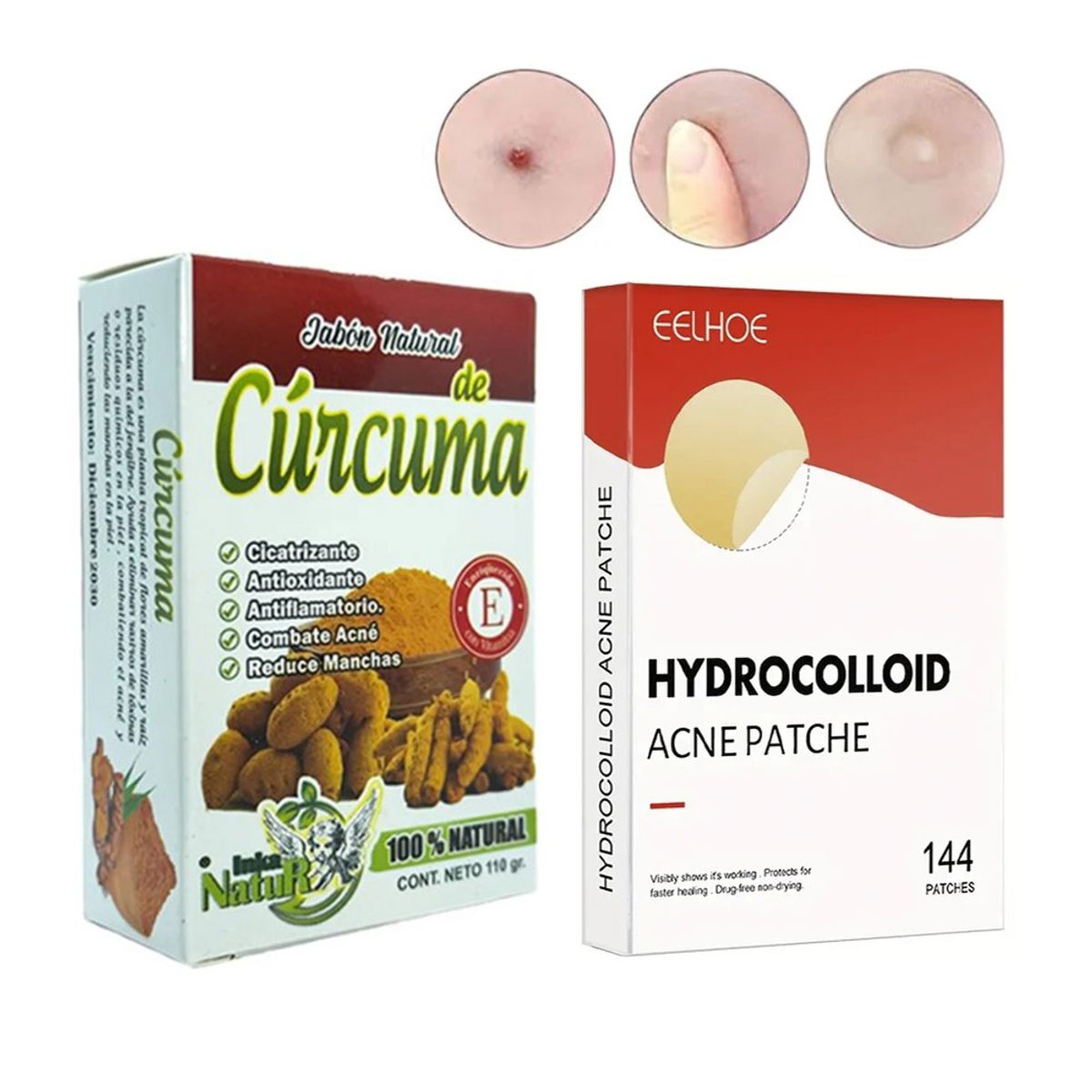 GENERICO - PATCH eliminador de acne144 unidades jabon de curcuma anti-inflamatoria
