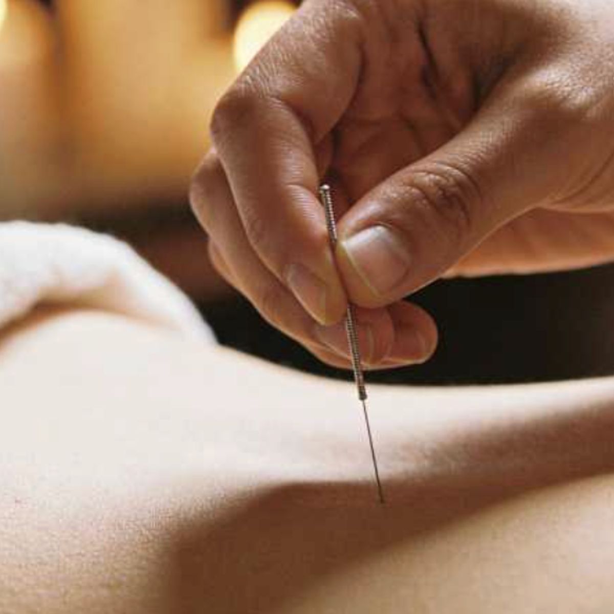 GENERICO - ACUPUNTURA 0.30MM X 1.5" CAJA X 100 UNIDADES (VENCIMIENTO JUNIO 2028)