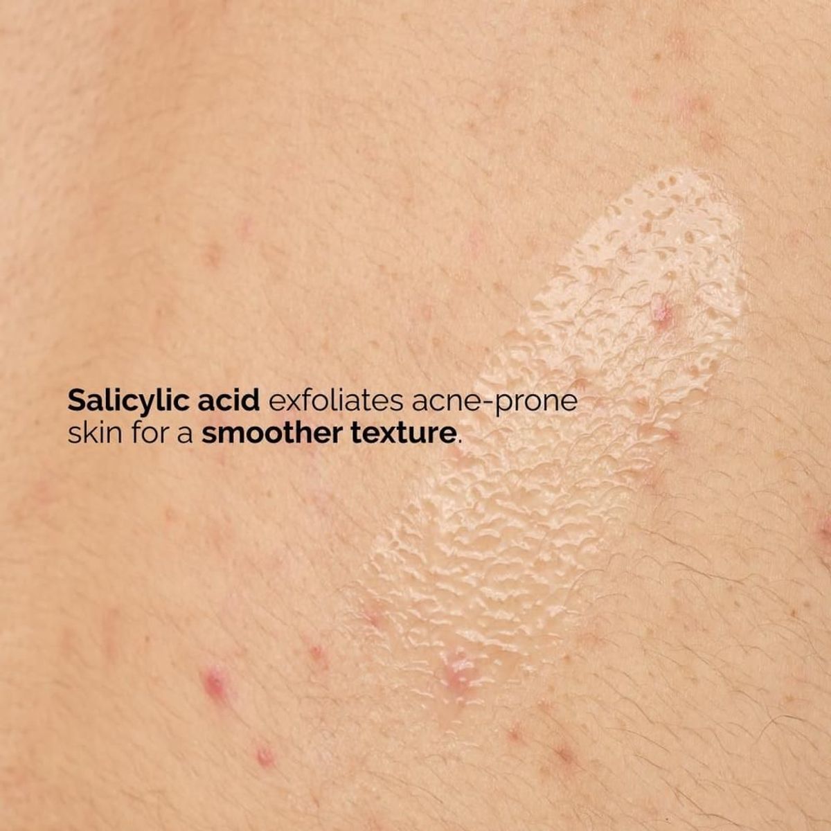 THE ORDINARY - THE ORDINARY SÉRUM CORPORAL ÁCIDO SALICÍLICO 0.5% EXFOLIANTE  240 ML.
