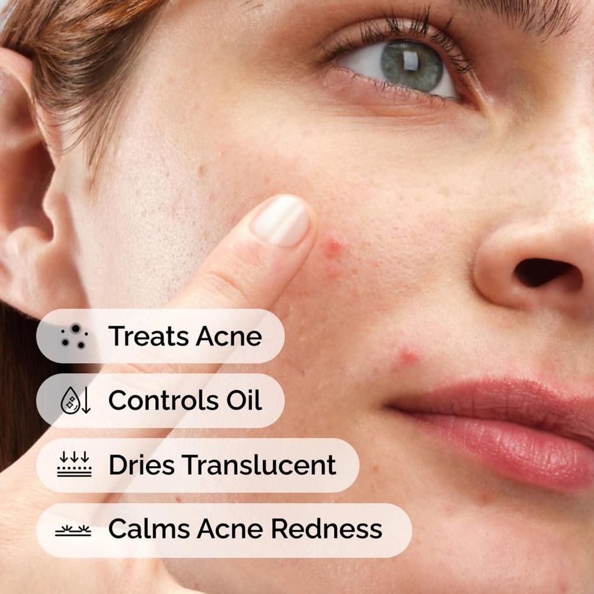 THE ORDINARY - THE ORDINARY TRATAMIENTO DE AZUFRE 10% POLVO A CREMA PARA ACNÉ  5 ML.