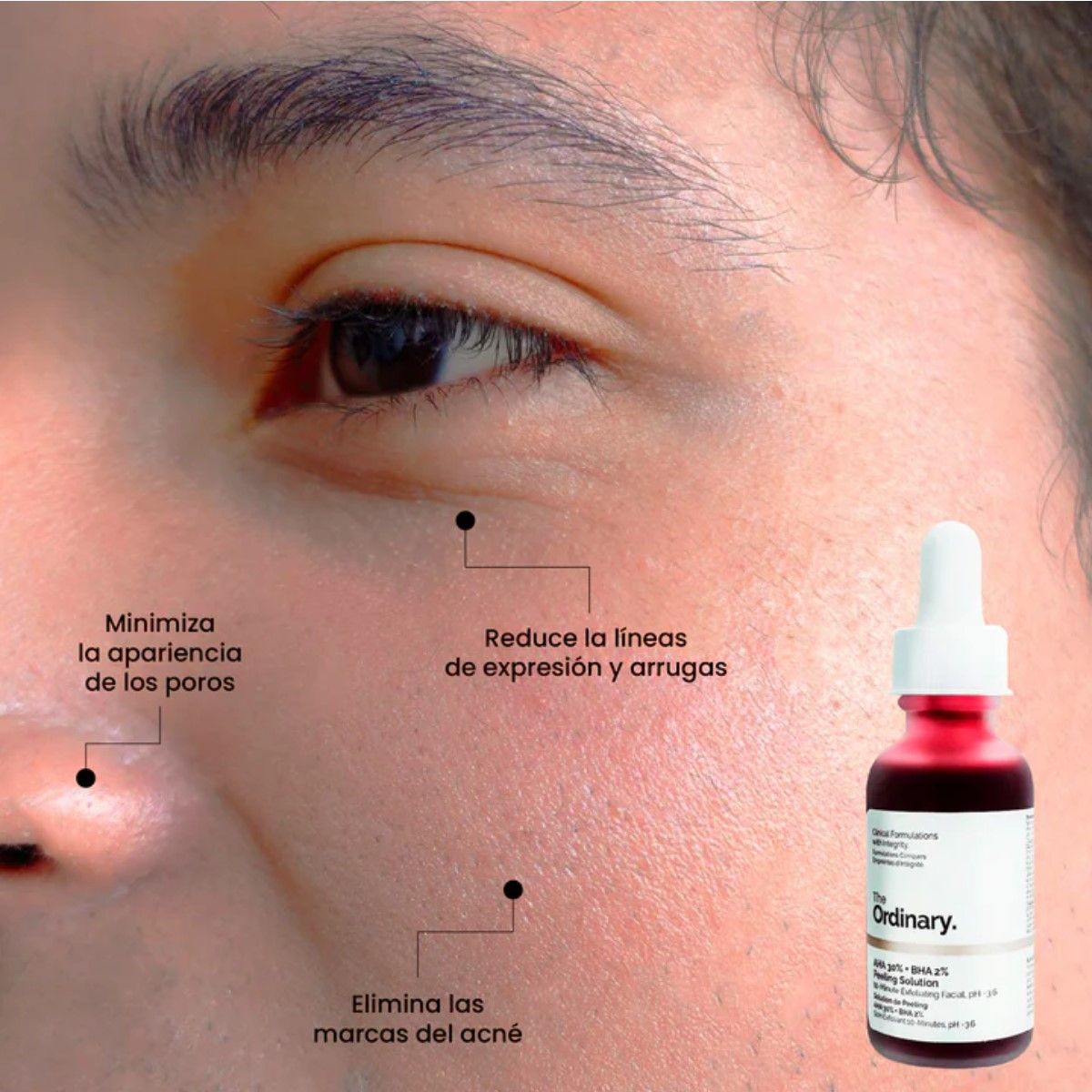 THE ORDINARY - The Ordinary AHA 30% + BHA 2% Peeling Solution 30 ml Original