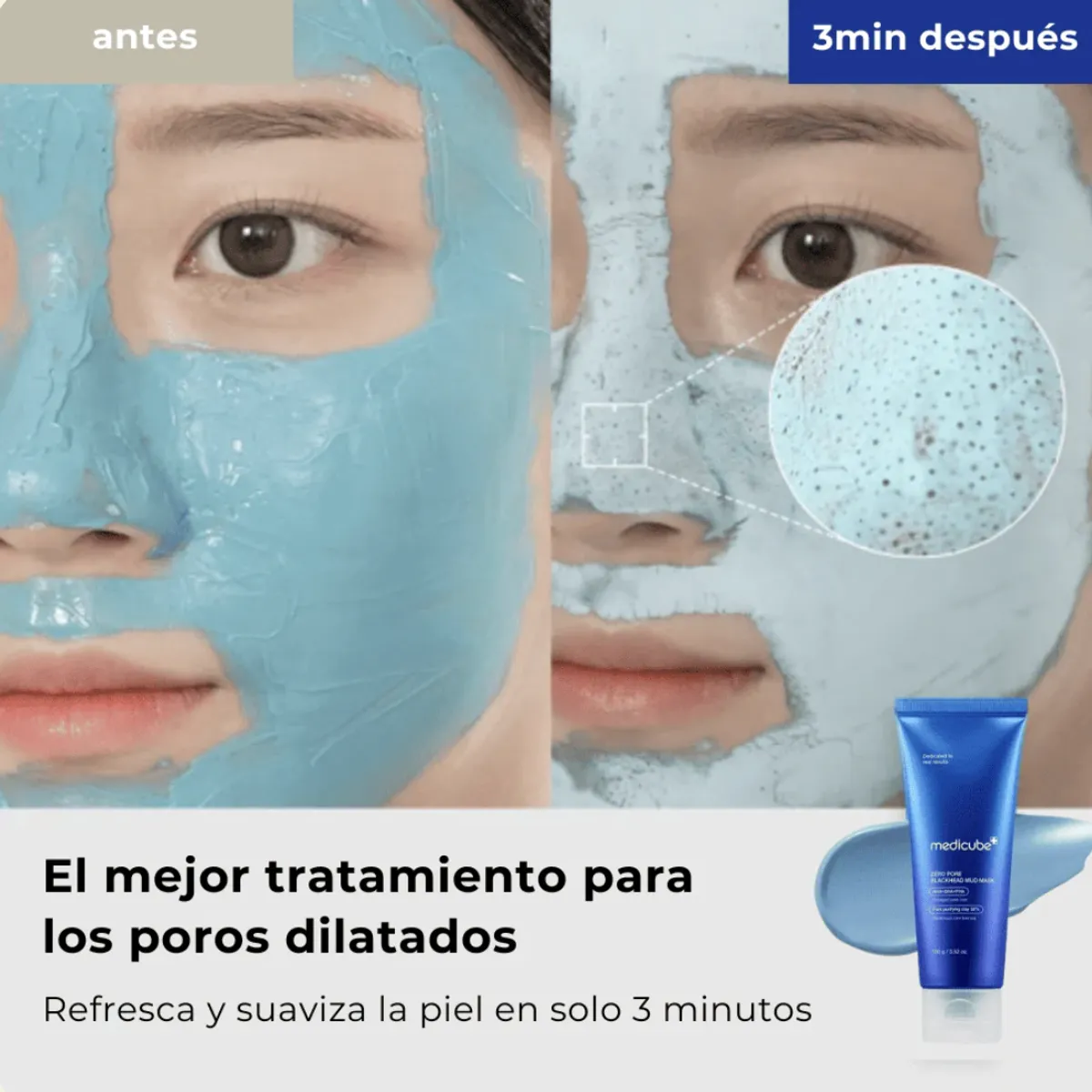 LE COREANE - Medicube Zero Pore Blackhead Mud Mask